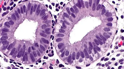 Micrografía del endometrio Micrografía del endometrio