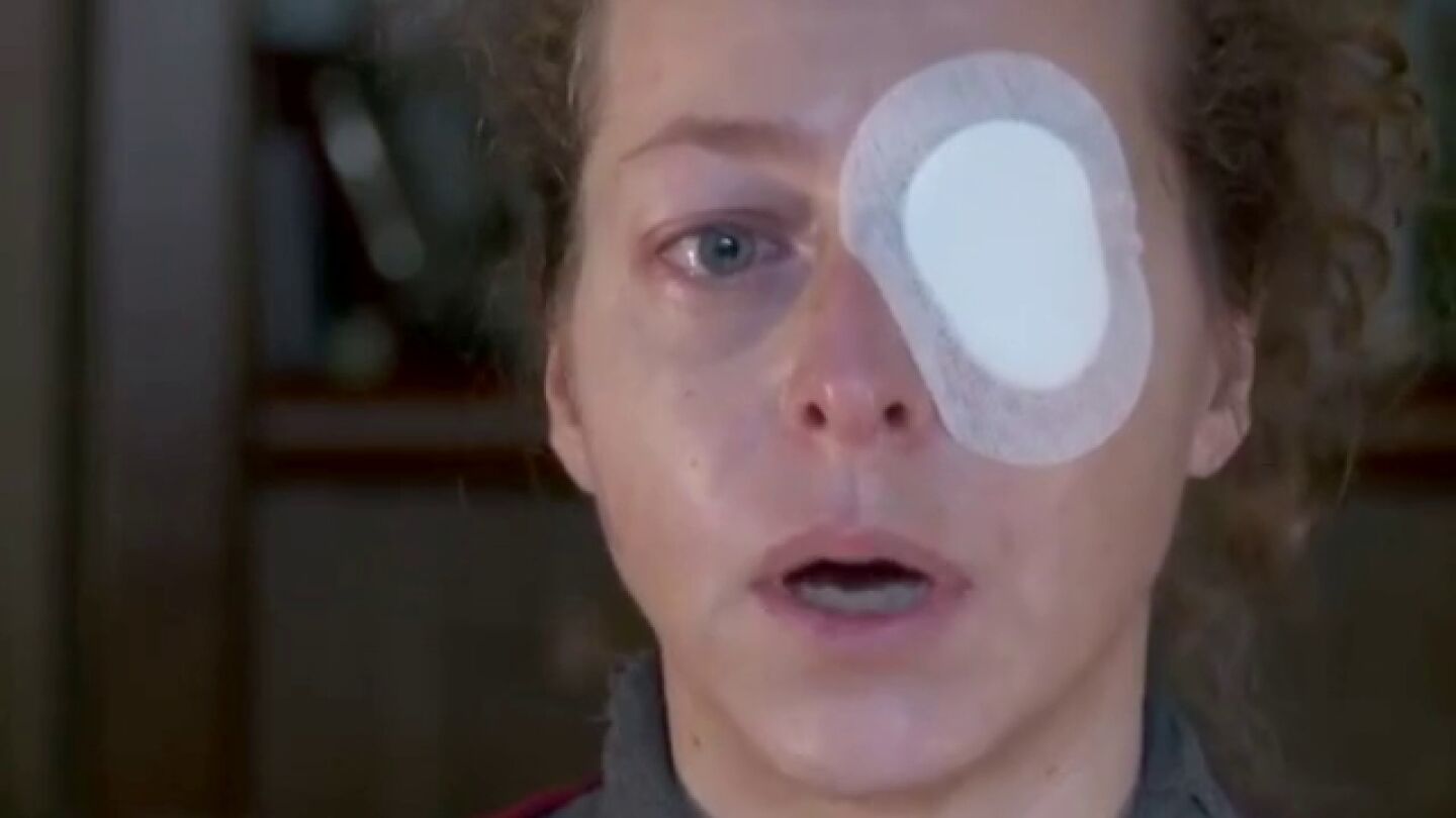 Esther Quintana cuenta c&oacute;mo perdi&oacute; un ojo