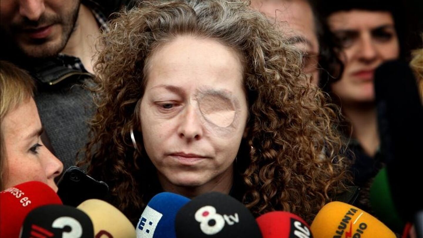 Ester Quintana, la mujer que perdi&oacute; el ojo durante las protestas del 14N. 