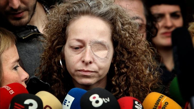 Ester Quintana, la mujer que perdió el ojo durante las protestas del 14N. 