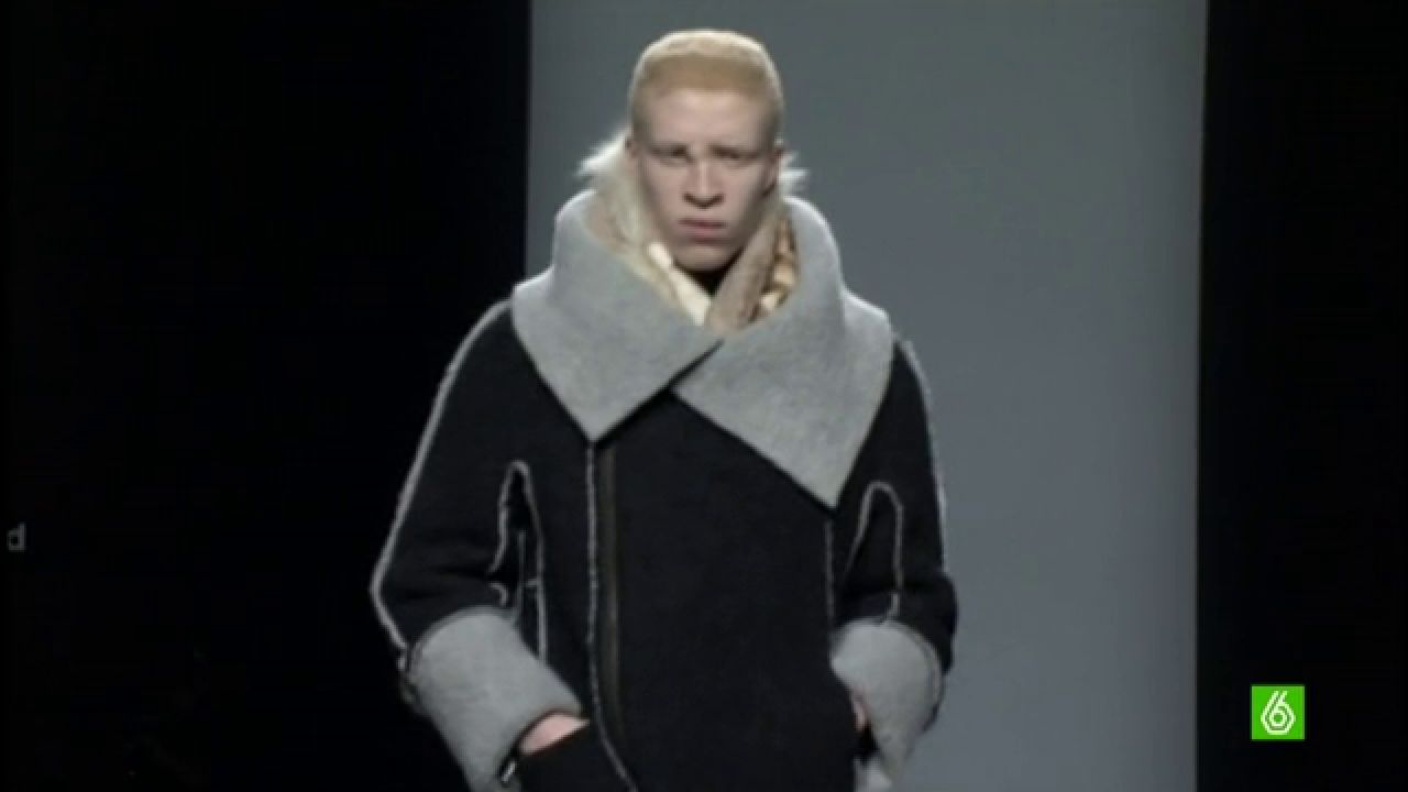 El único modelo albino del mundo