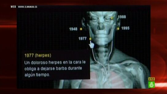 El Intermedio