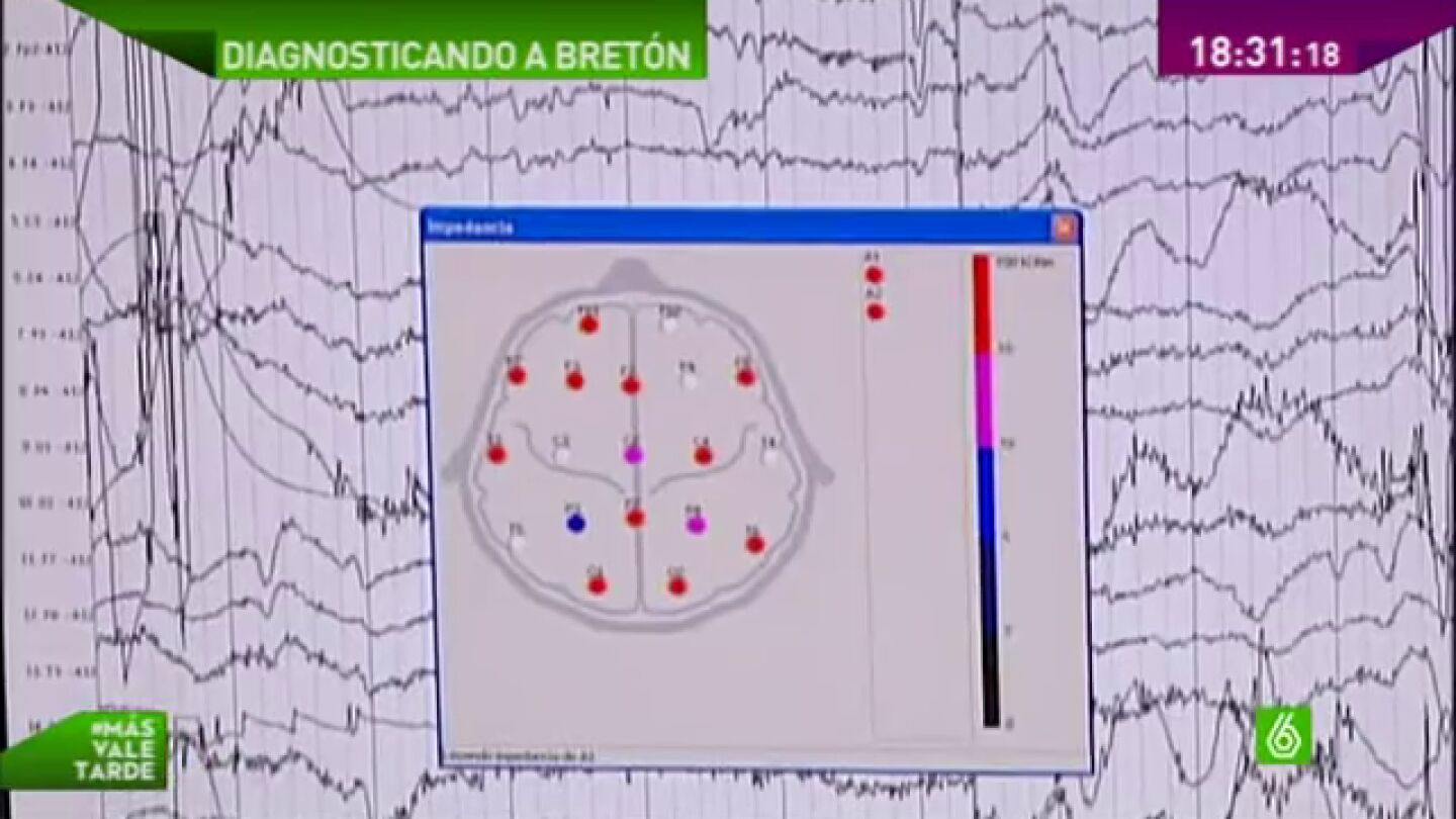 &iquest;Qu&eacute; pasa por la cabeza de Jos&eacute; Bret&oacute;n?