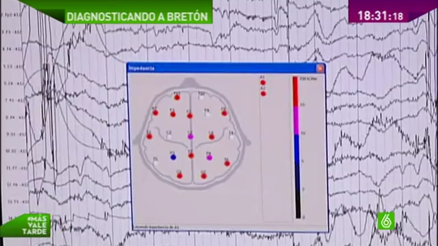 ¿Qué pasa por la cabeza de José Bretón? ¿Qué pasa por la cabeza de José Bretón?
