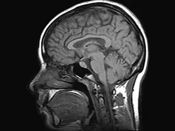 Imagen IRM de un escáner cerebral Imagen IRM de un escáner cerebral