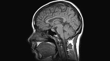 Imagen IRM de un escáner cerebral