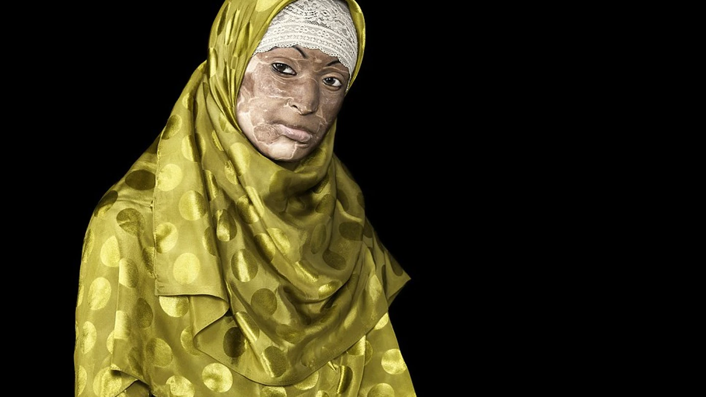 Ayesha Siddika, atacada tras una pelea matrimonial Ayesha Siddika, atacada tras una pelea matrimonial
