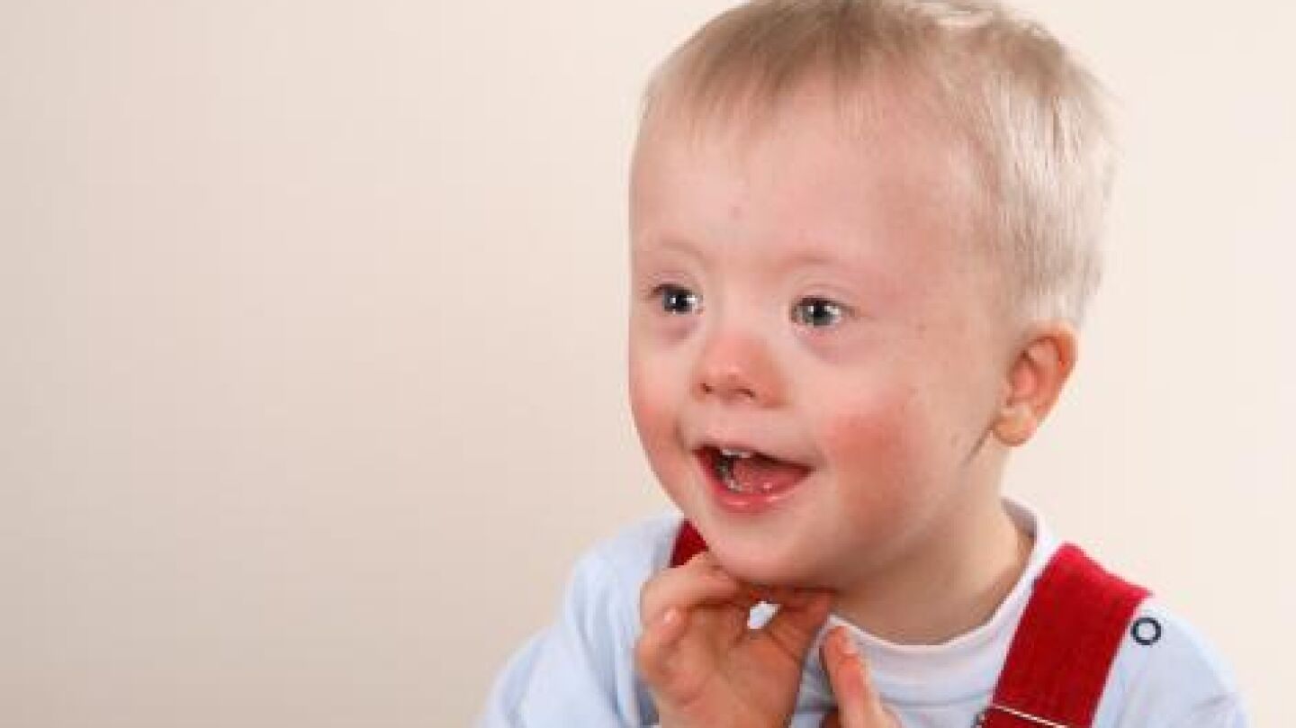 Ni&ntilde;o con s&iacute;ndrome de down