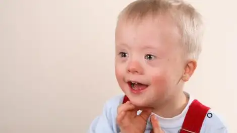 Niño con síndrome de down