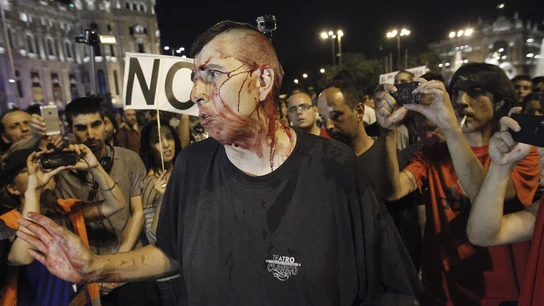 Uno de los manifestantes golpeados: "Que salgan a la calle los que chatean por facebook y twitter" Uno de los manifestantes golpeados: "Que salgan a la calle los que chatean por facebook y twitter"
