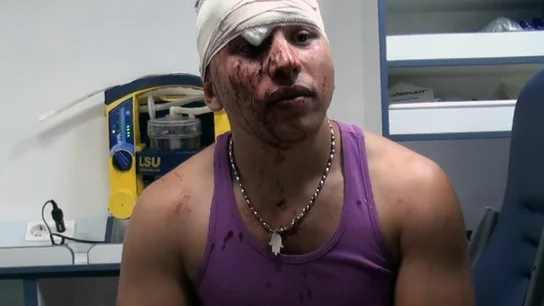 Joven agredido con un botellazo Joven agredido con un botellazo