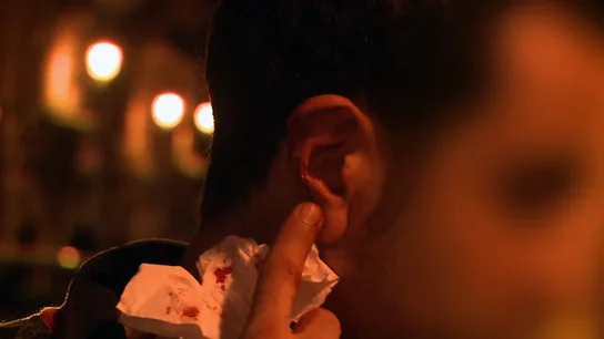 Le pegan un mordisco en la oreja a un joven Le pegan un mordisco en la oreja a un joven