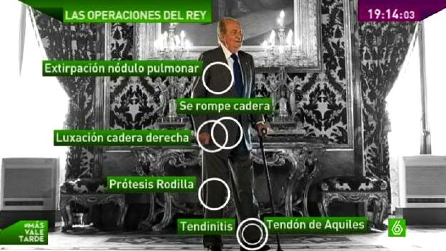 Imagen con las operaciones del rey