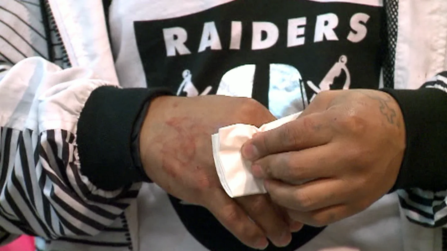 Latino herido en una reyerta Latino herido en una reyerta