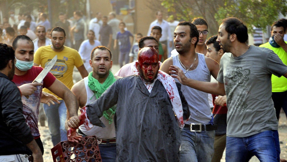 Un manifestante herido en Egipto