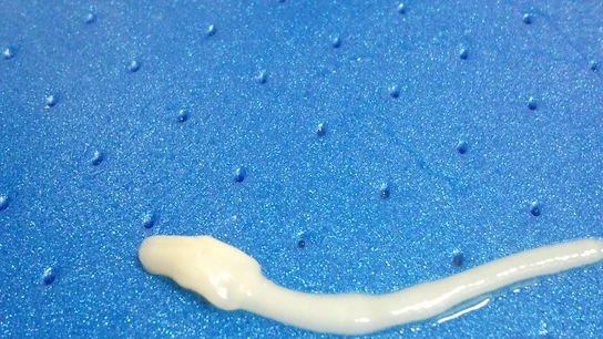 anisakis anisakis