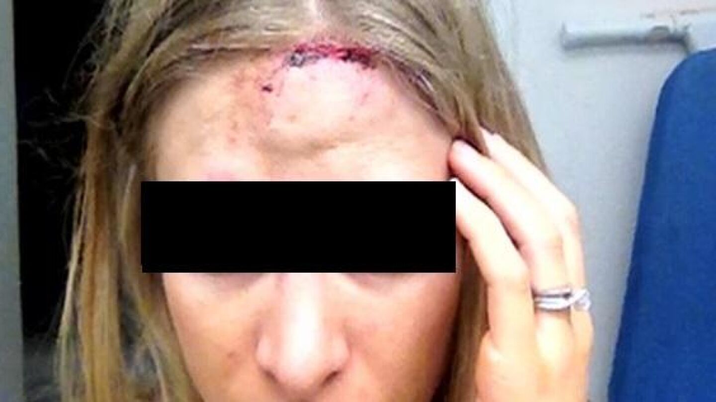 Una de las v&iacute;ctimas apedreadas a la salida del instituto en Murcia