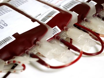 transfusión de sangre transfusión de sangre