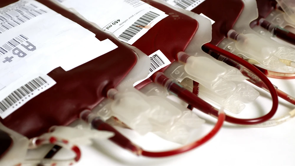 transfusión de sangre