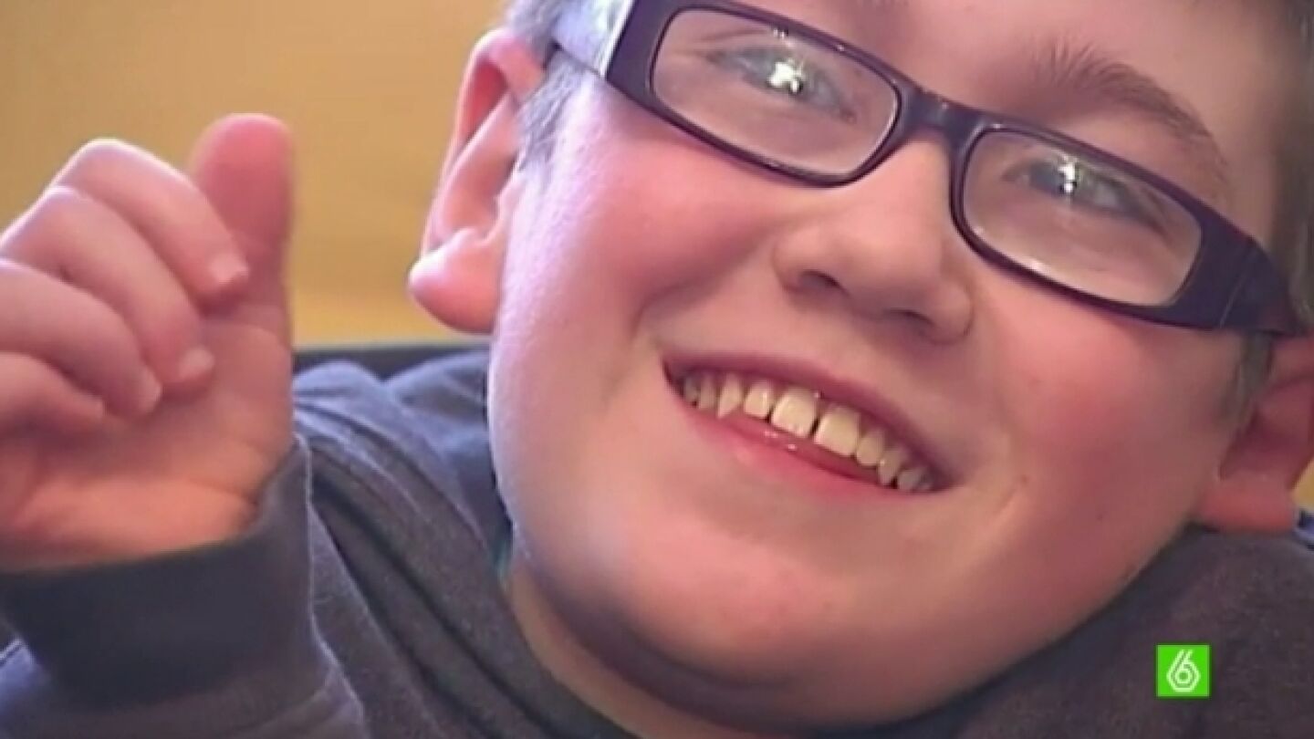 Miguel, ni&ntilde;o con s&iacute;ndrome de Morquio