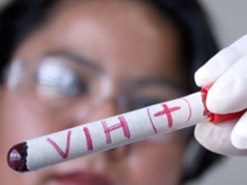Muestra de VIH en un laboratorio Muestra de VIH en un laboratorio