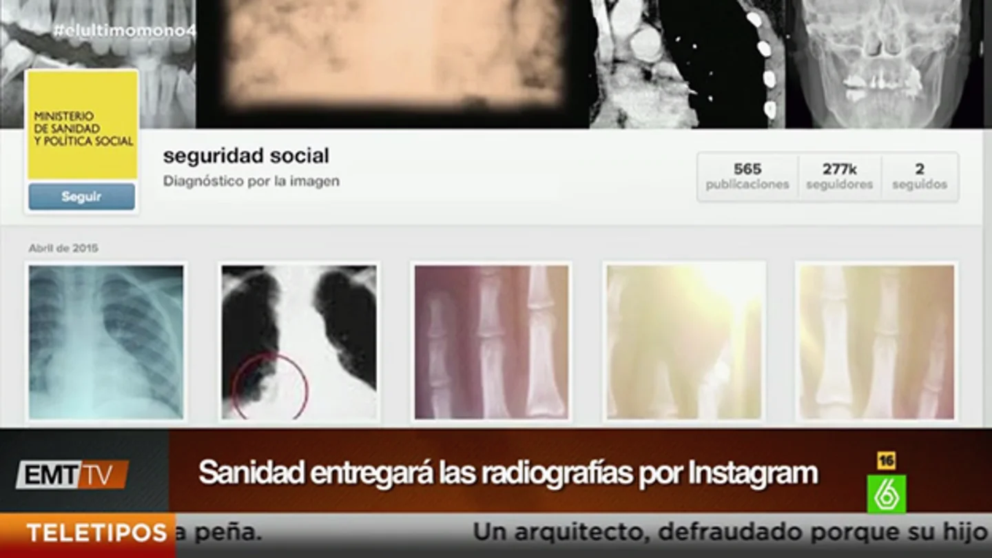 La Seguridad Social entregará las radiografías por Instagram La Seguridad Social entregará las radiografías por Instagram