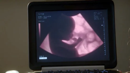 La prueba de que el embarazo de Molly es real La prueba de que el embarazo de Molly es real