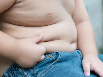 Aproximadamente un tercio de los obesos Aproximadamente un tercio de los obesos