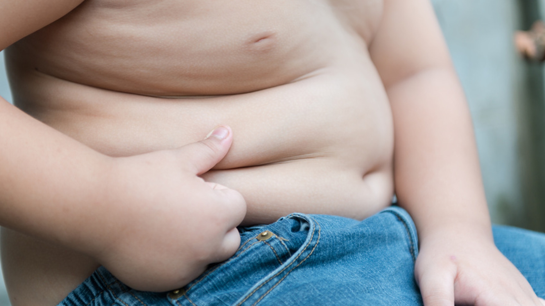 Aproximadamente un tercio de los obesos
