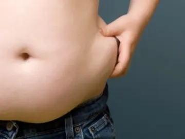 Acumulación de grasa abdominal Acumulación de grasa abdominal