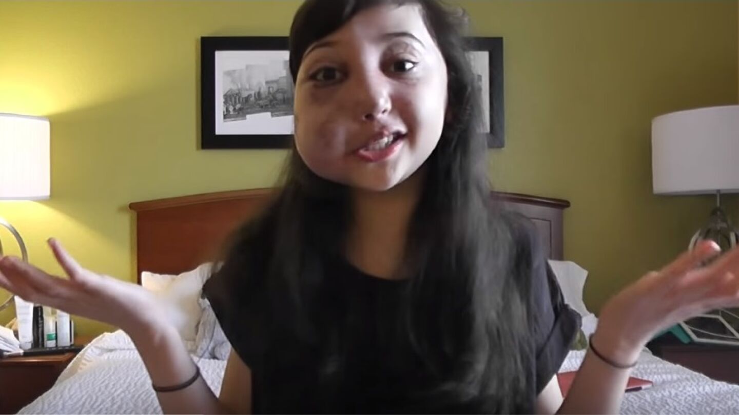 La lucha de Nikki por su enfermedad rara arrasa en la red