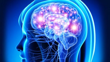 Cerebro