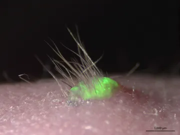 Tejido al que le crece el pelo Tejido al que le crece el pelo