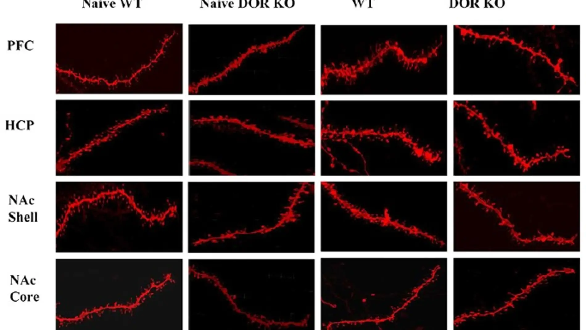 Figura: Cambios neuronales inducidos por