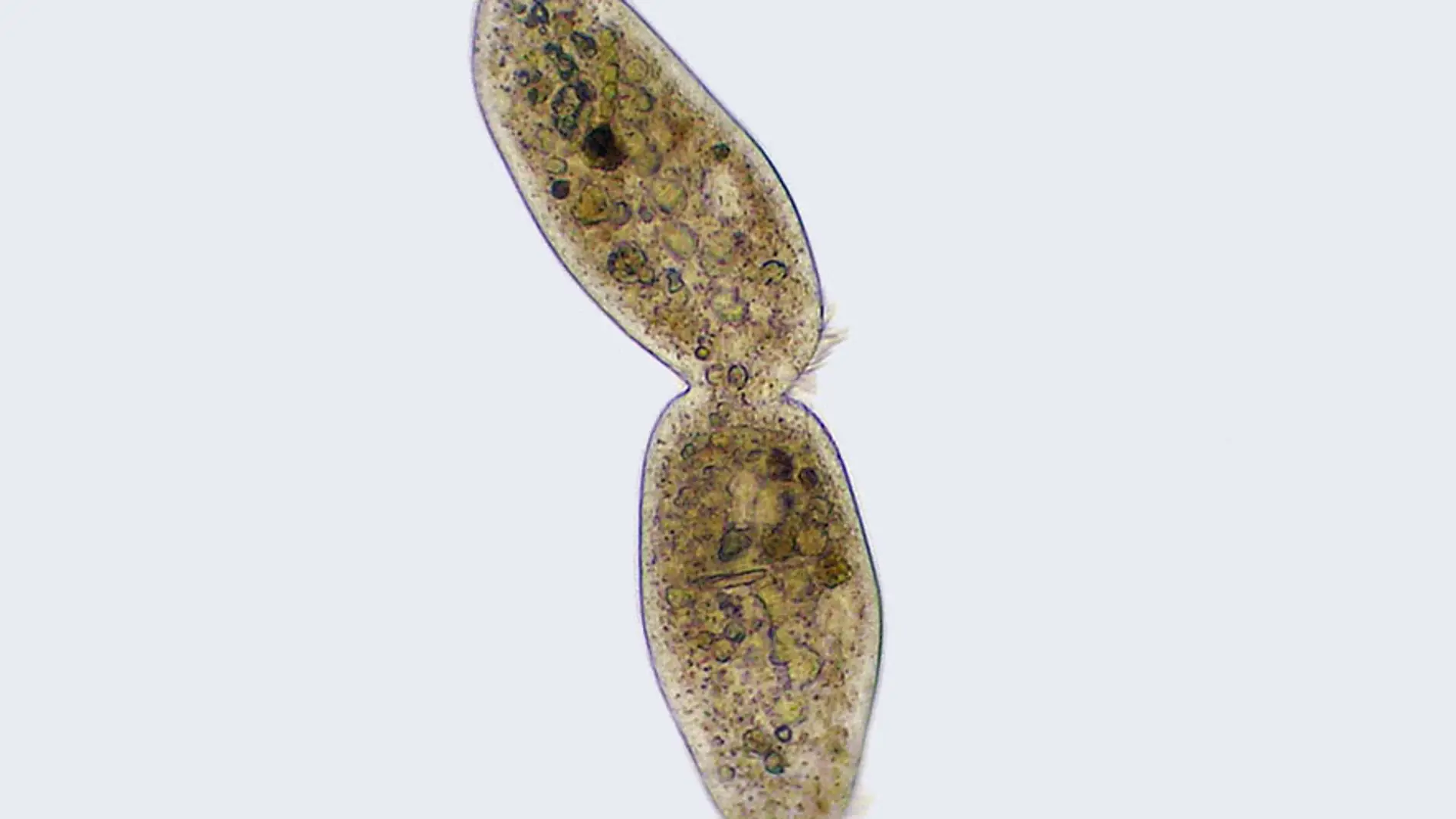Imagen al microscopio de una ciliophora.