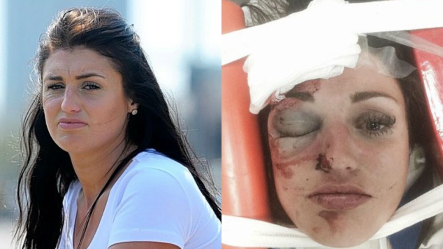 Imagen de la agredida