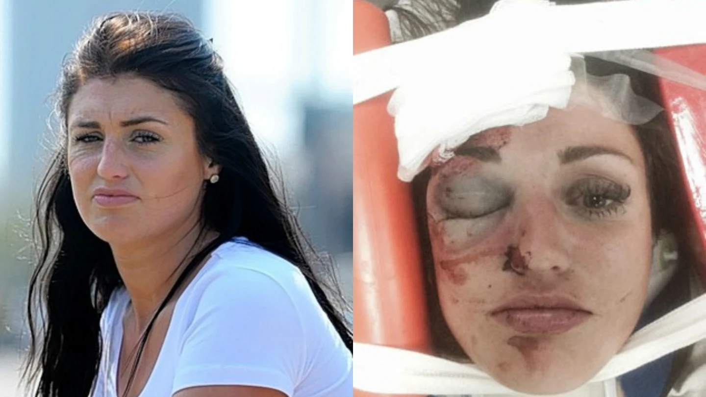 Imagen de la agredida Imagen de la agredida