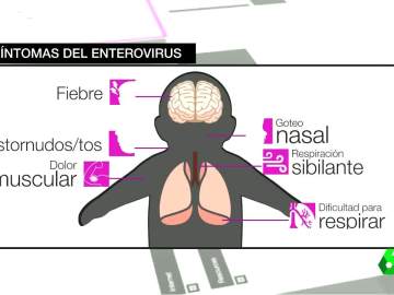 Síntomas del enterovirus Síntomas del enterovirus