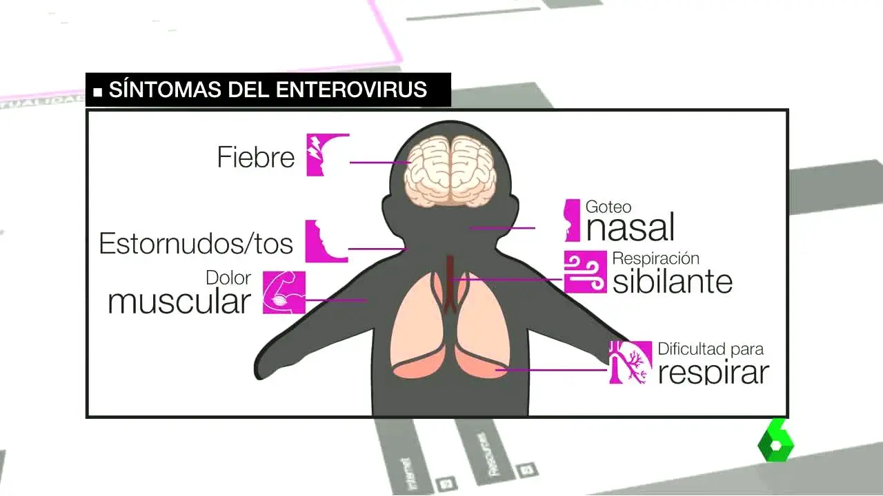 Síntomas del enterovirus Síntomas del enterovirus