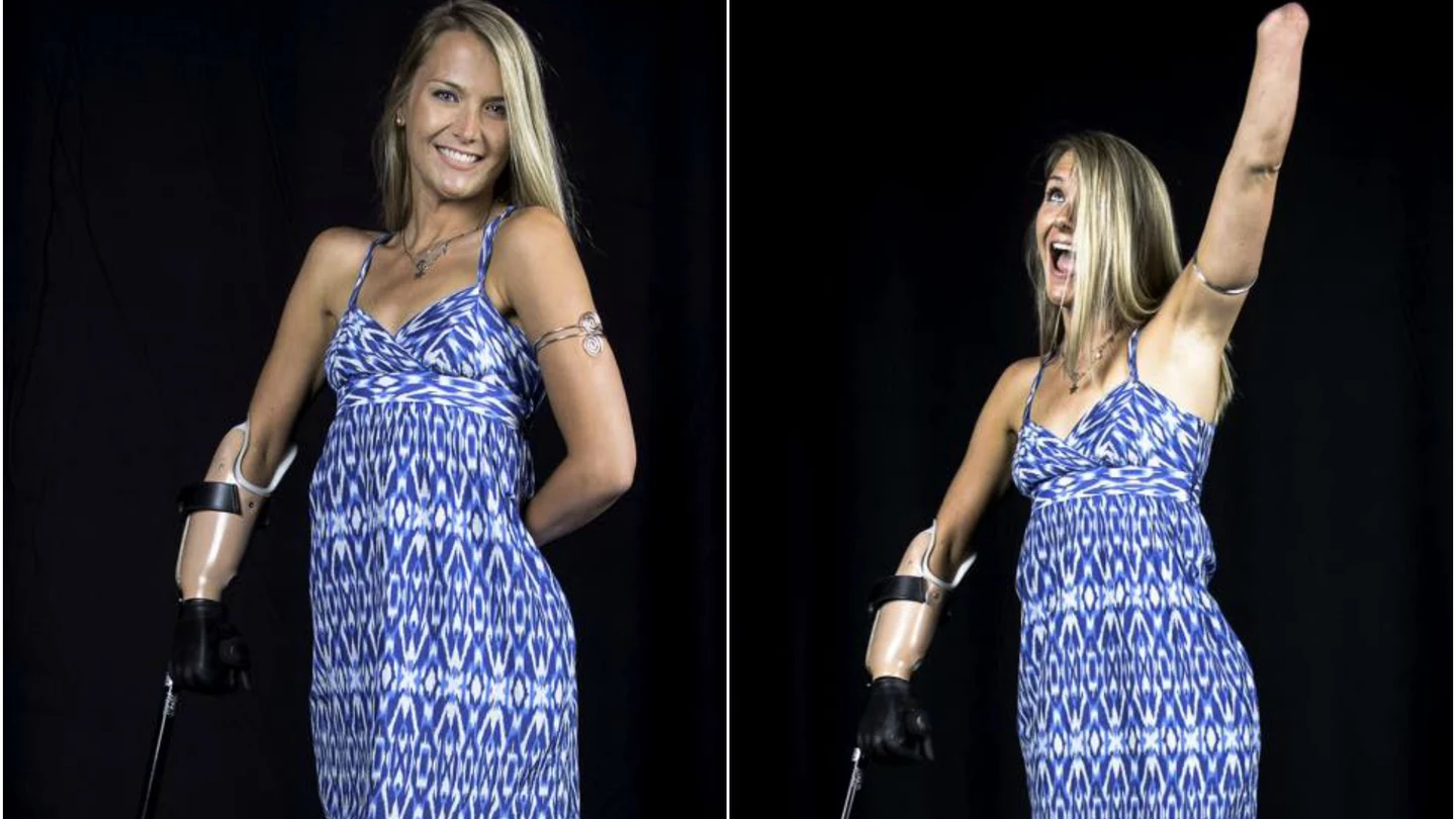 Aimee Copeland Aimee Copeland