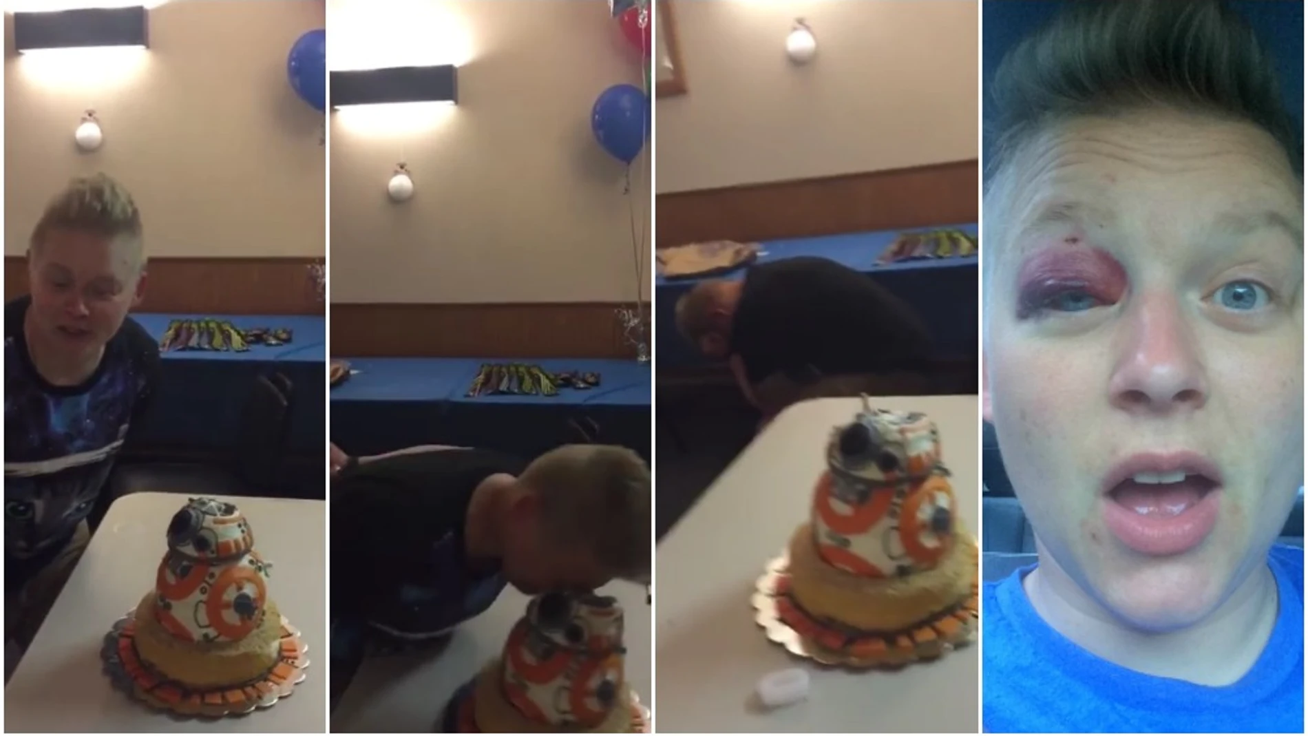 Una joven estampa su cara contra una tarta de cumpleaños y casi pierde un ojo 