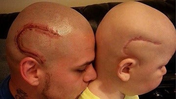Un padre se tatúa la cicatriz de su hijo
