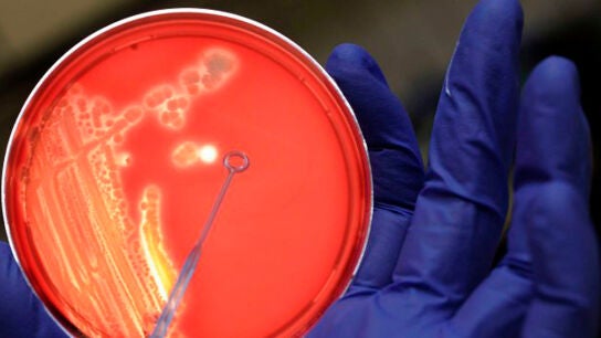 bacterias