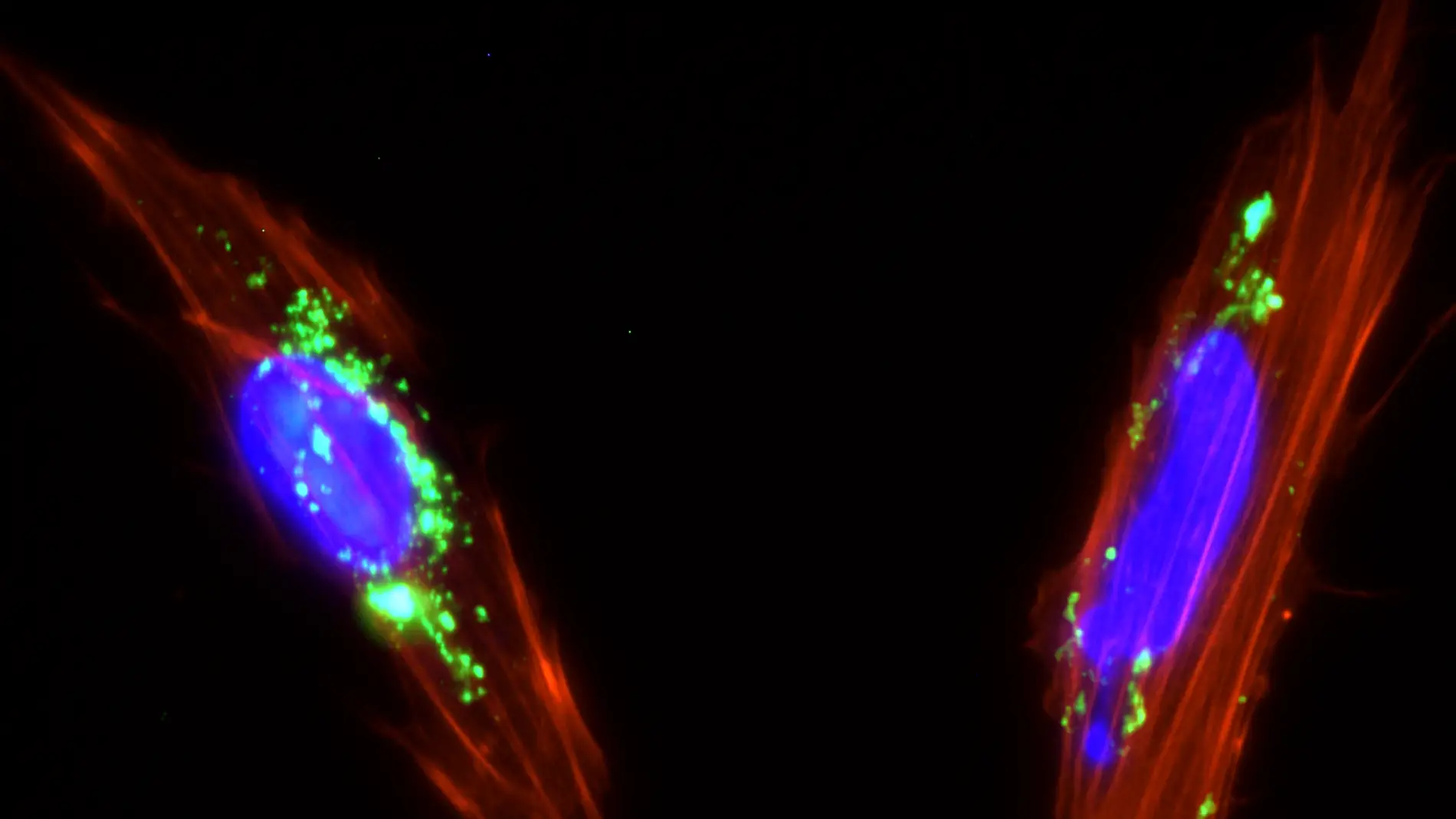 Células mesenquimales de placenta con na