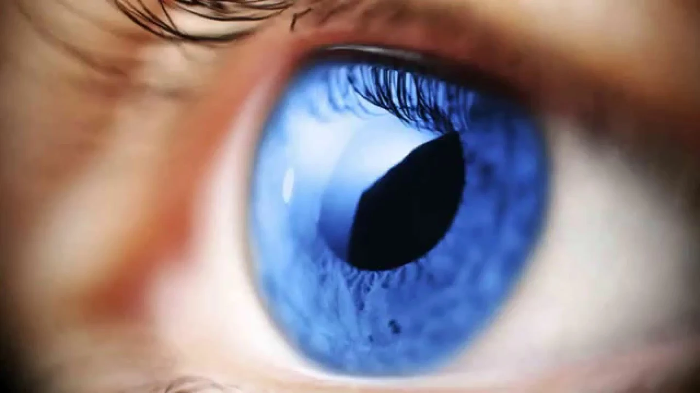 El glaucoma El glaucoma