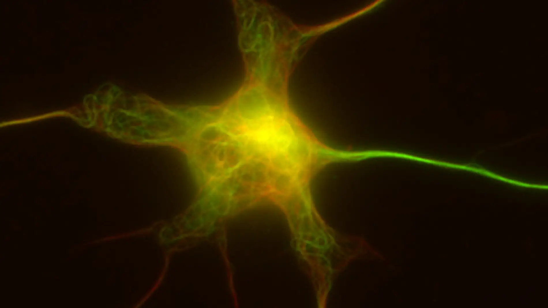 Micritúublos en una neurona de ratón