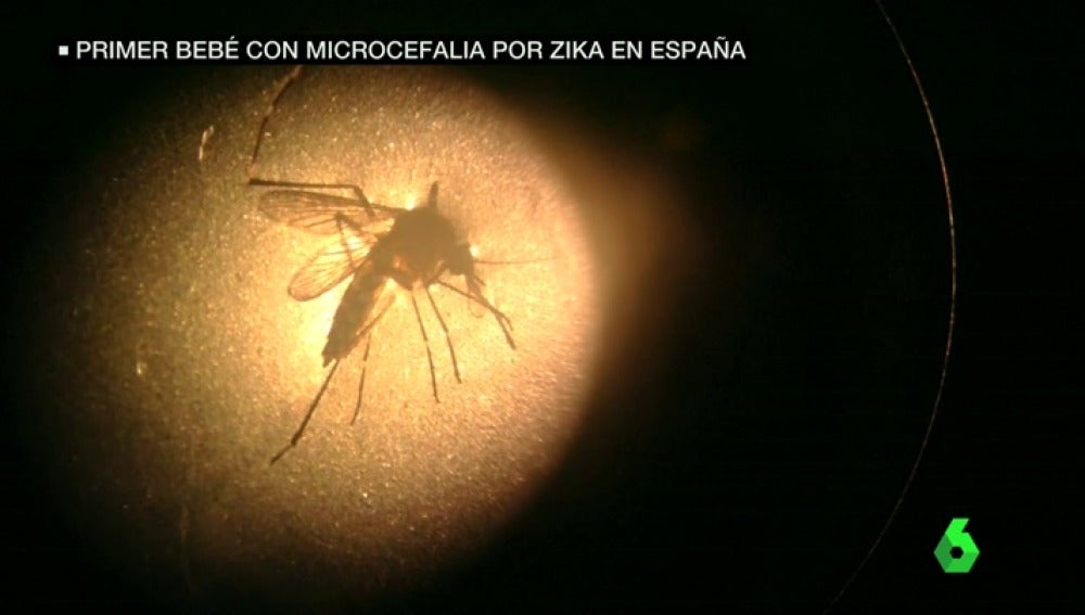 Frame 7.027771 de: zika