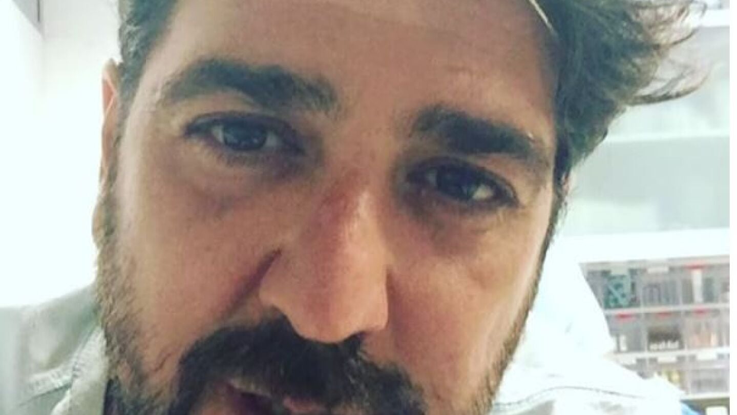 Antonio Orozco despu&eacute;s del accidente 