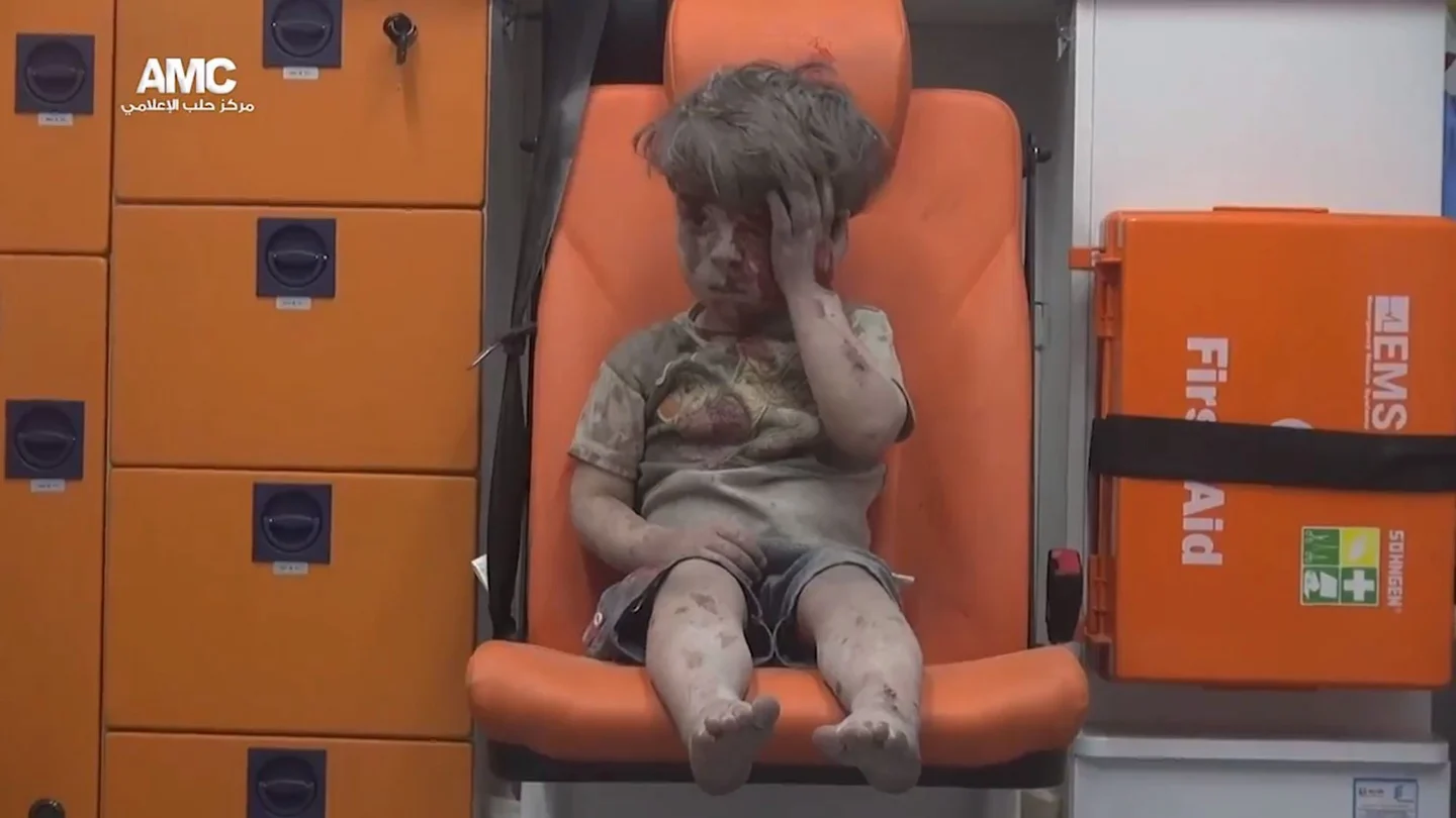 Omran, la cara de la guerra de Siria Omran, la cara de la guerra de Siria