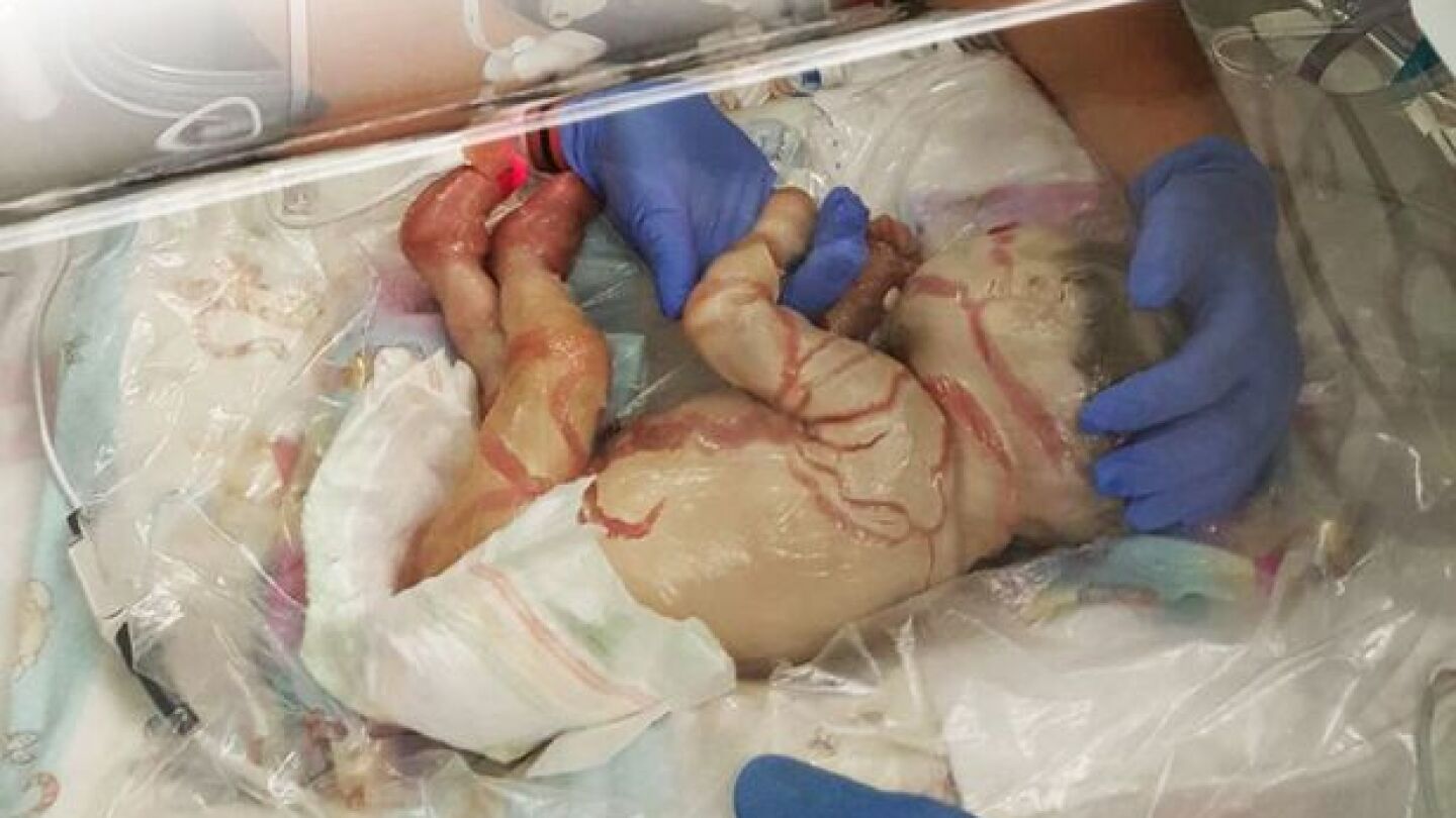 Harper, al nacer